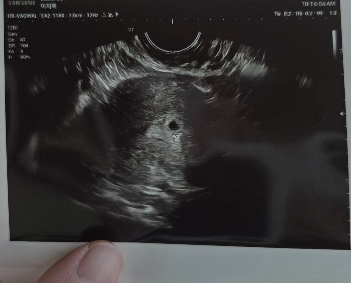 [임신일기-03] 아기집 집들이하러 병원에 방문하다. (4-5주차, 쓰리라인임테기, 동탄제일병원, 임신확인서) 임신일기3 2