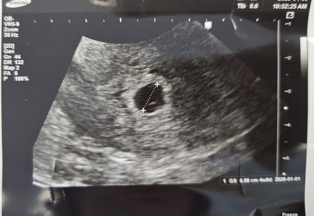 [임신일기-03] 아기집 집들이하러 병원에 방문하다. (4-5주차, 쓰리라인임테기, 동탄제일병원, 임신확인서) 임신일기3 8